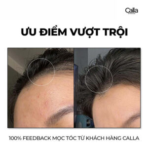 Spa chăm sóc phục hồi tóc hư tổn