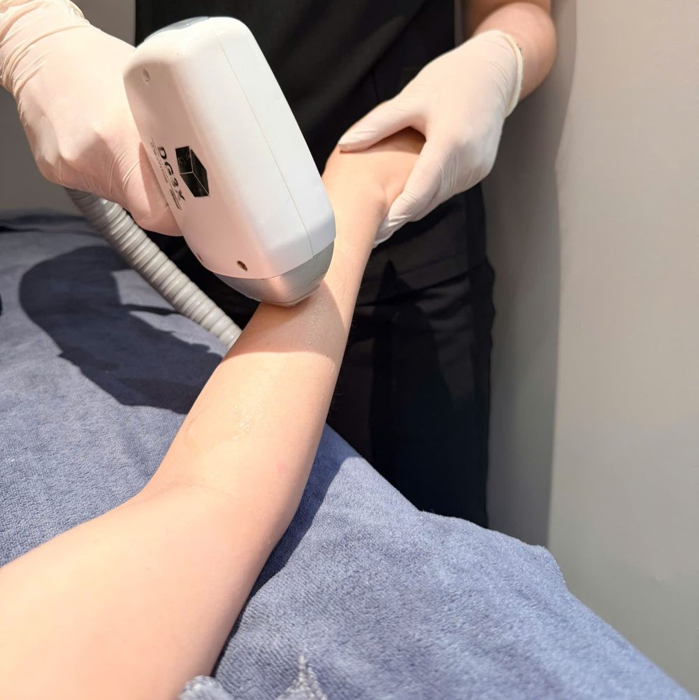 Spa triệt lông công nghệ mới nhất tại Long Thành